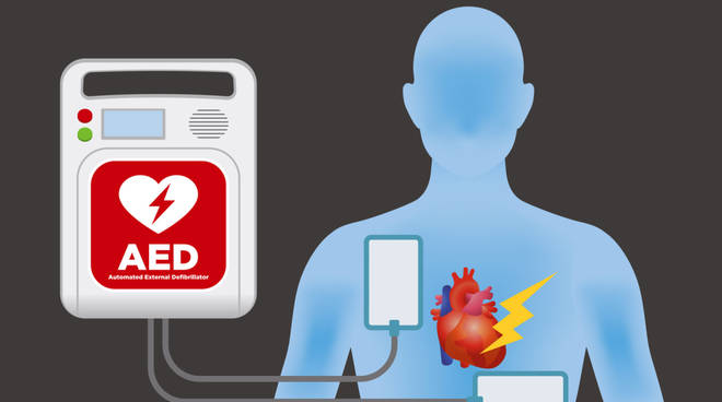 Defibrillatori sparsi