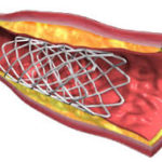 images-1